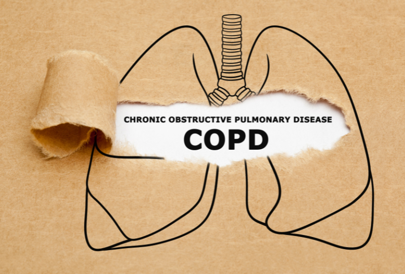 Waarom online fysiotherapie bij COPD?